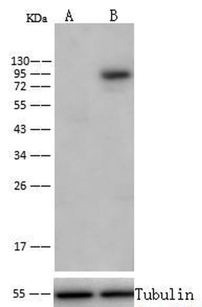 Transferrin Receptor Antibody in Western Blot (WB)