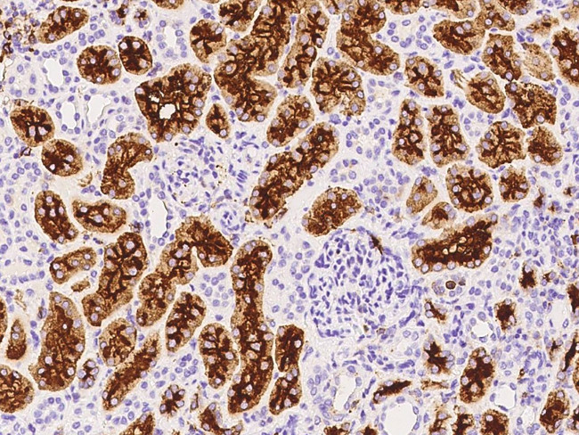 CD13 Antibody in Immunohistochemistry (Paraffin) (IHC (P))