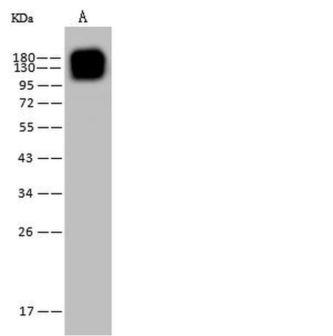 CD13 Antibody in Western Blot (WB)