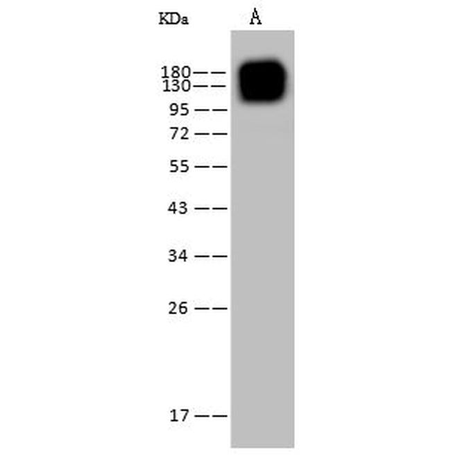 CD13 Antibody in Western Blot (WB)