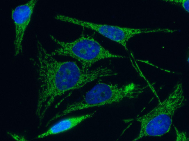 C1QBP Antibody in Immunocytochemistry (ICC/IF)