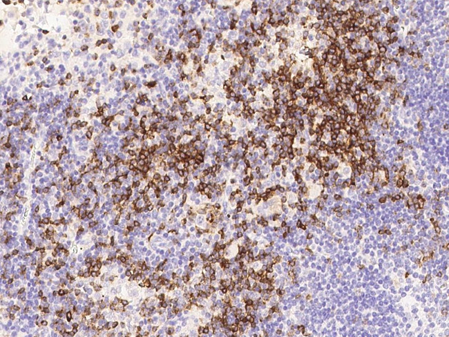 CD7 Antibody in Immunohistochemistry (Paraffin) (IHC (P))