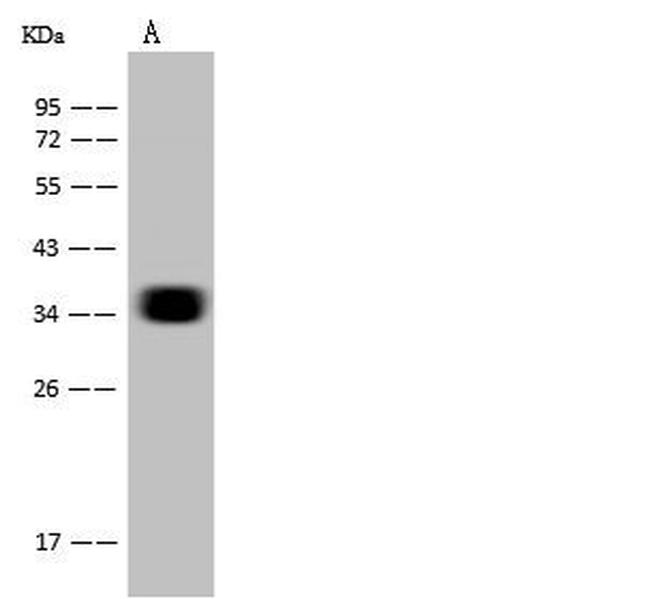 CD7 Antibody in Western Blot (WB)