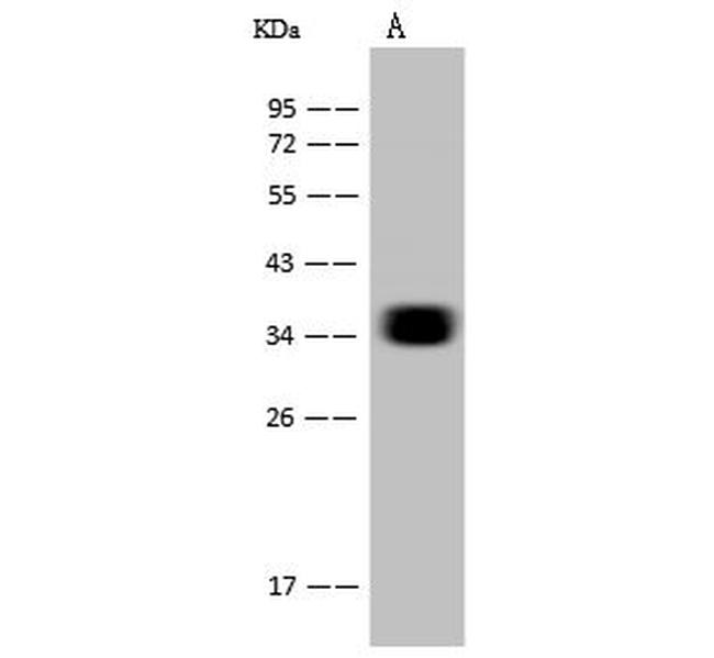 CD7 Antibody in Western Blot (WB)