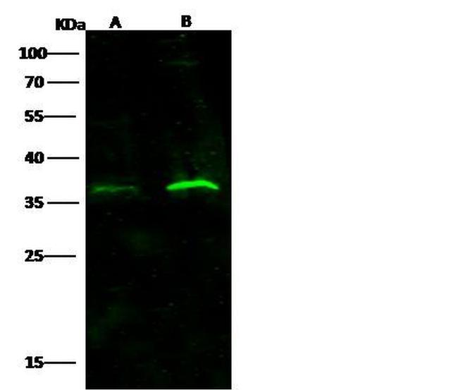 IFNAR2 Antibody in Western Blot (WB)