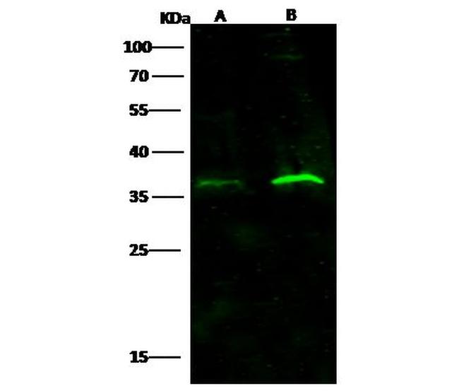 IFNAR2 Antibody in Western Blot (WB)