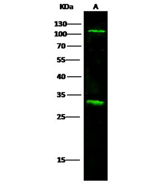 IL17RA Antibody in Western Blot (WB)