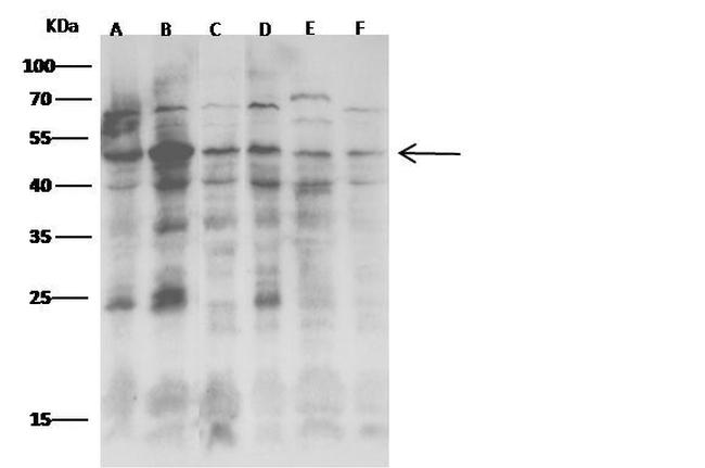 JNK2 Antibody in Western Blot (WB)