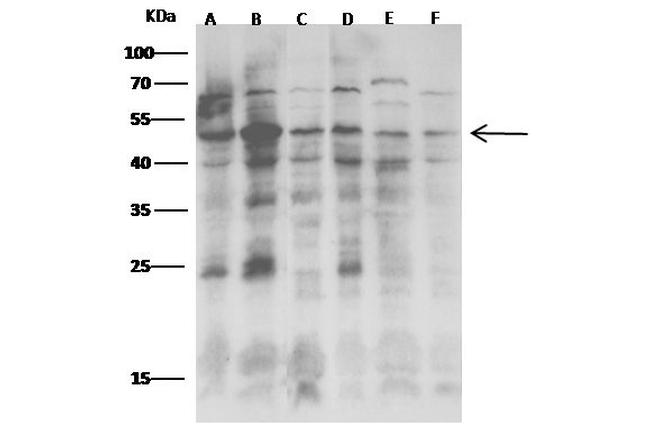 JNK2 Antibody in Western Blot (WB)