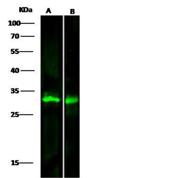 METTL1 Antibody in Western Blot (WB)