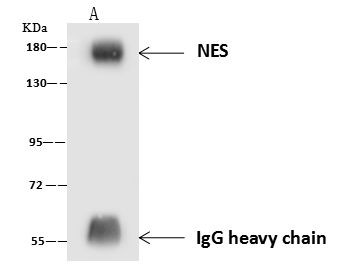 Nestin Antibody in Immunoprecipitation (IP)