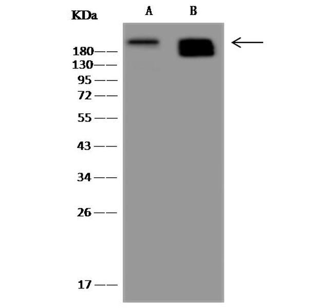 Nestin Antibody in Western Blot (WB)