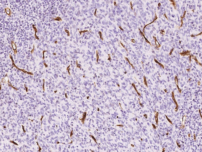 Nestin Antibody in Immunohistochemistry (Paraffin) (IHC (P))