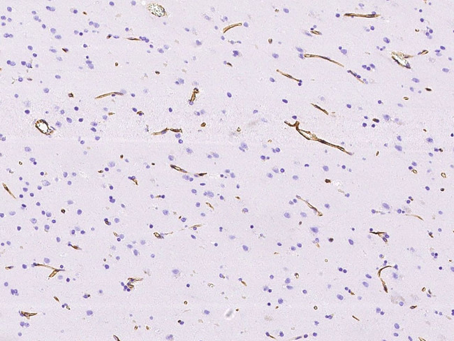 Nestin Antibody in Immunohistochemistry (Paraffin) (IHC (P))