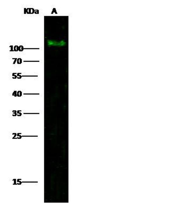 PDGFRA Antibody in Western Blot (WB)