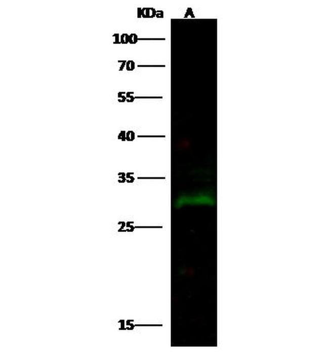 PRTFDC1 Antibody in Western Blot (WB)