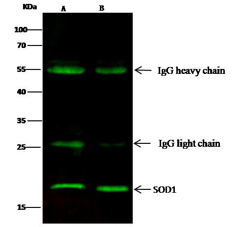 SOD1 Antibody in Immunoprecipitation (IP)