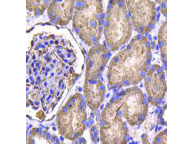 IDH1 Antibody in Immunohistochemistry (Paraffin) (IHC (P))