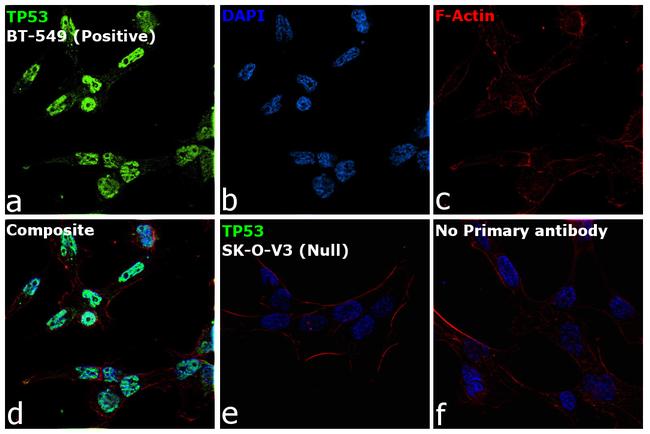 p53 Antibody in Immunocytochemistry (ICC/IF)