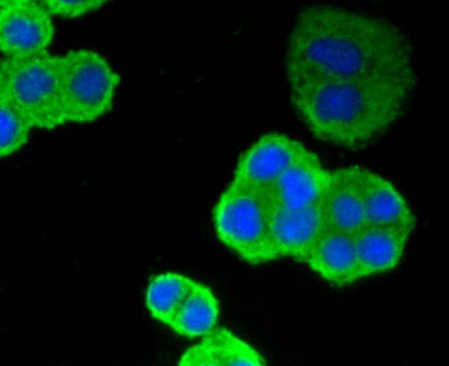 p53 Antibody in Immunocytochemistry (ICC/IF)