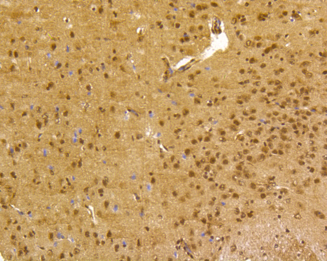 CREB Antibody in Immunohistochemistry (Paraffin) (IHC (P))