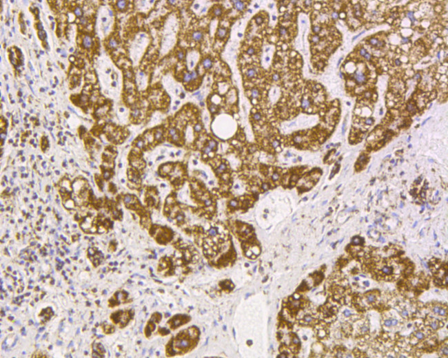 VDAC Antibody in Immunohistochemistry (Paraffin) (IHC (P))