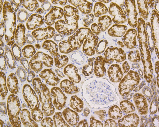 VDAC Antibody in Immunohistochemistry (Paraffin) (IHC (P))