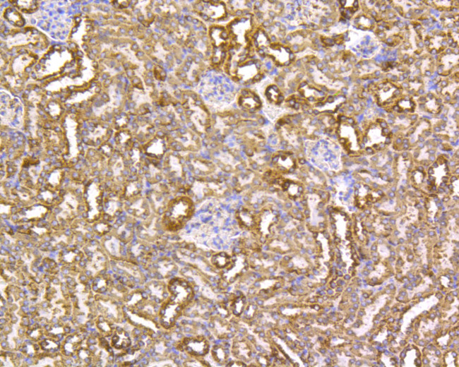 VDAC Antibody in Immunohistochemistry (Paraffin) (IHC (P))