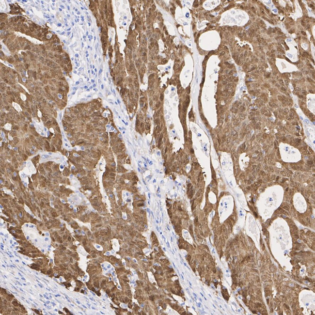 beta Catenin Antibody in Immunocytochemistry (ICC/IF)