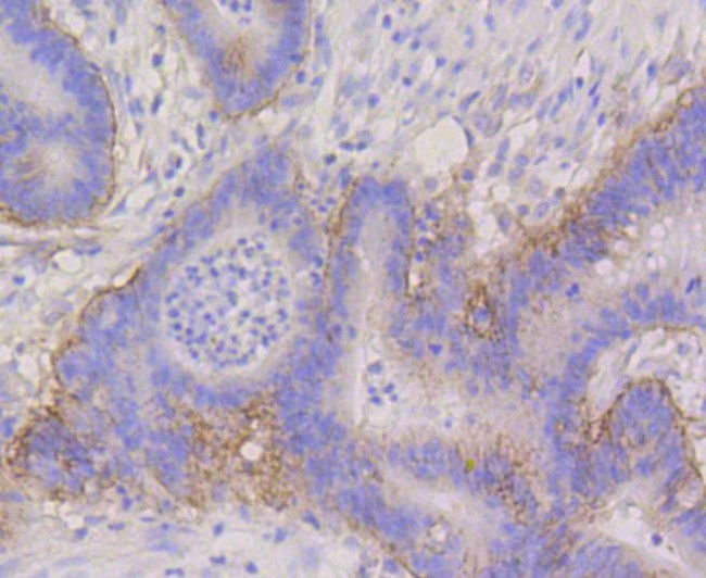 CD49f Antibody in Immunohistochemistry (Paraffin) (IHC (P))