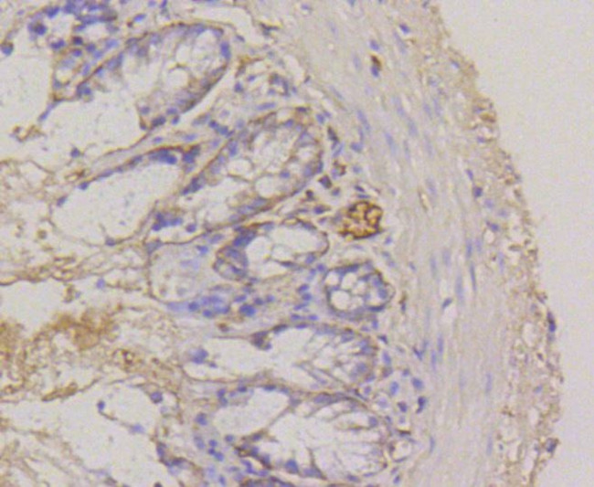 CD49f Antibody in Immunohistochemistry (Paraffin) (IHC (P))