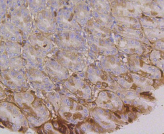 CD49f Antibody in Immunohistochemistry (Paraffin) (IHC (P))