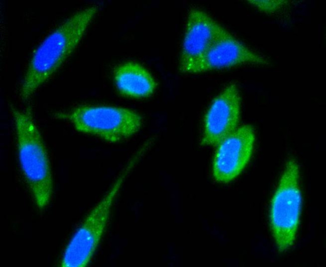 FAK Antibody in Immunocytochemistry (ICC/IF)