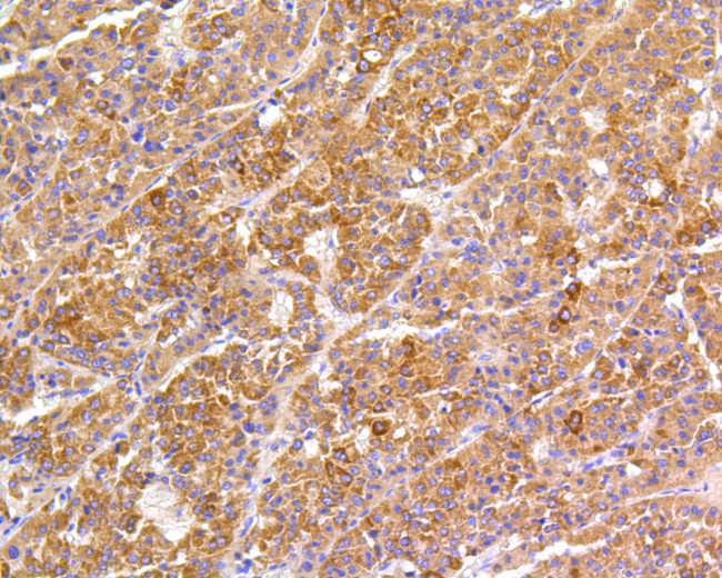 FAK Antibody in Immunohistochemistry (Paraffin) (IHC (P))