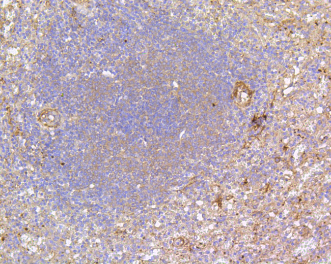 FAK Antibody in Immunohistochemistry (Paraffin) (IHC (P))