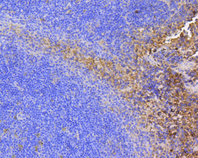 FAK Antibody in Immunohistochemistry (Paraffin) (IHC (P))