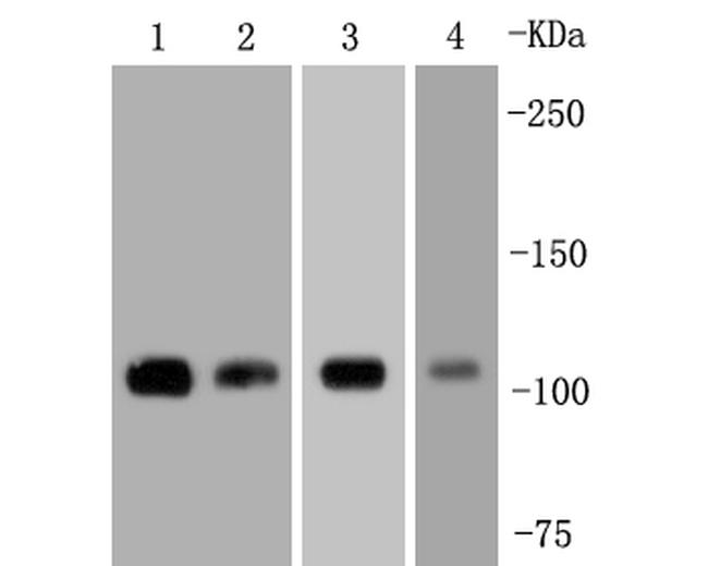 FAK Antibody in Western Blot (WB)