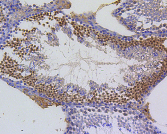 Survivin Antibody in Immunohistochemistry (Paraffin) (IHC (P))