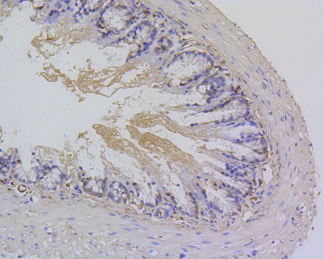 Survivin Antibody in Immunohistochemistry (Paraffin) (IHC (P))