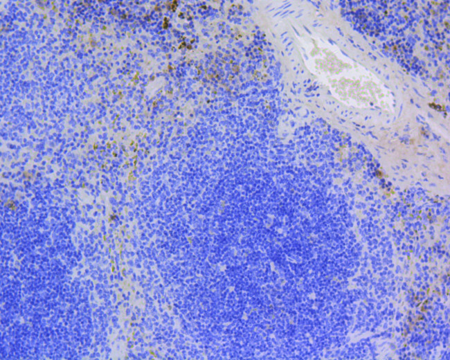 Survivin Antibody in Immunohistochemistry (Paraffin) (IHC (P))