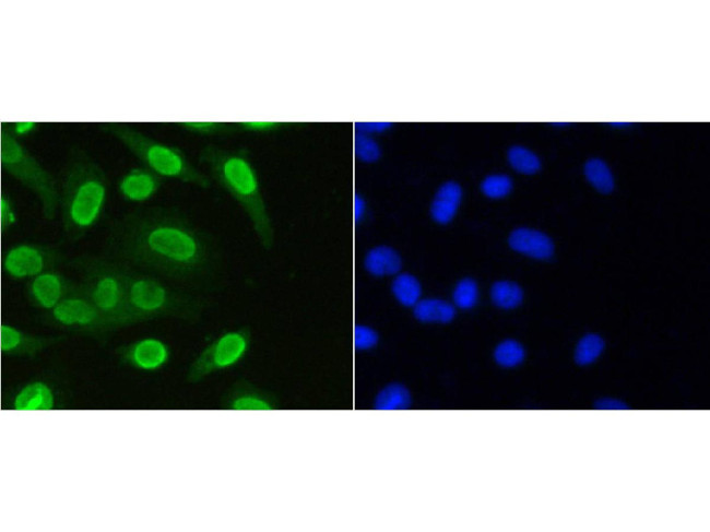 H3K36me1 Antibody in Immunocytochemistry (ICC/IF)