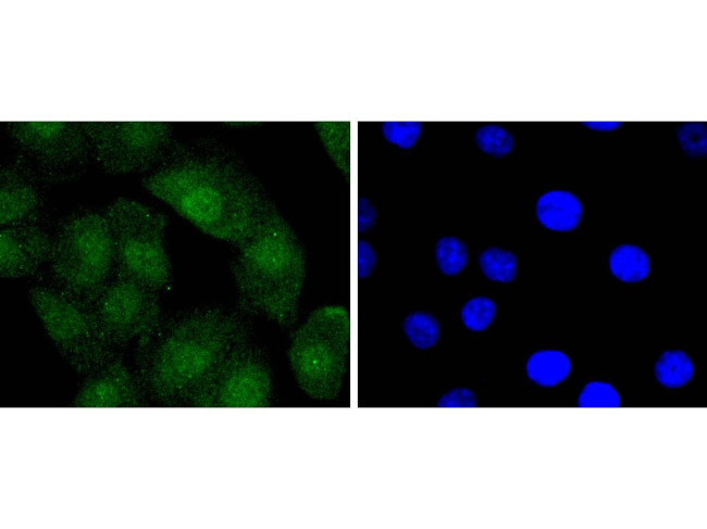 Bcl-2 Antibody in Immunocytochemistry (ICC/IF)