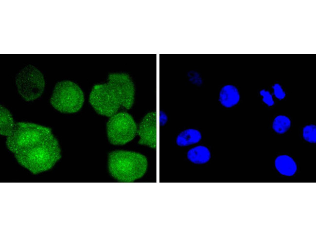 Bcl-2 Antibody in Immunocytochemistry (ICC/IF)