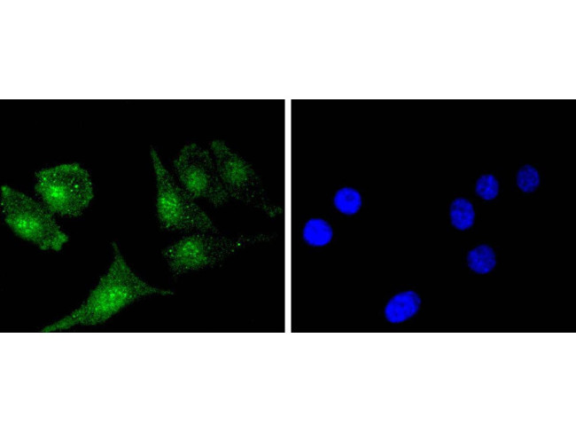 Bcl-2 Antibody in Immunocytochemistry (ICC/IF)