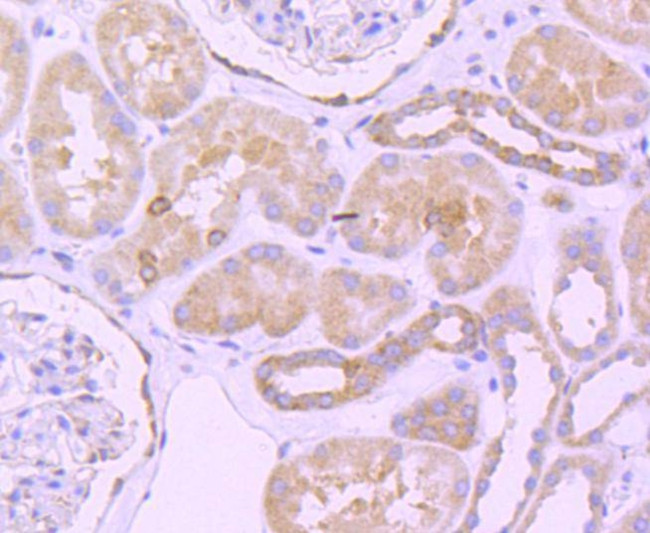 Bcl-2 Antibody in Immunohistochemistry (Paraffin) (IHC (P))