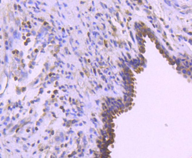 Bcl-2 Antibody in Immunohistochemistry (Paraffin) (IHC (P))