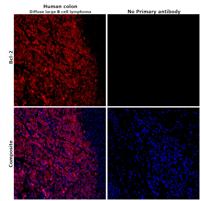 Bcl-2 Antibody in Immunohistochemistry (Paraffin) (IHC (P))