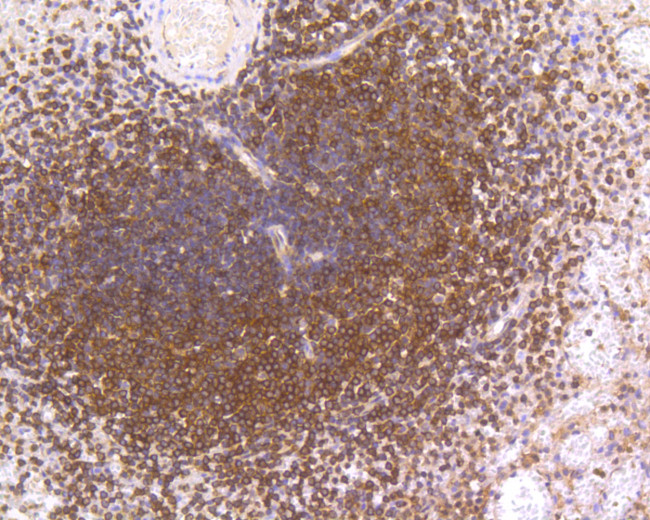 NFkB p50/p105 Antibody in Immunohistochemistry (Paraffin) (IHC (P))