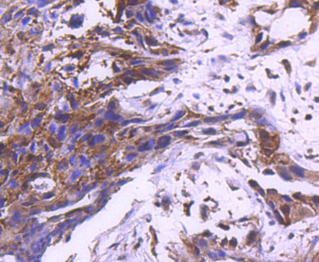 MEK1 Antibody in Immunohistochemistry (Paraffin) (IHC (P))