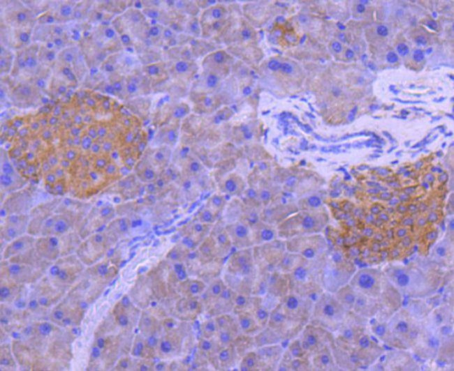 MEK1 Antibody in Immunohistochemistry (Paraffin) (IHC (P))